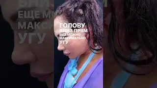Возвращаем время вспять с помощью подтяжки лица, сутки после операции, этап 3 #фейслифтинг