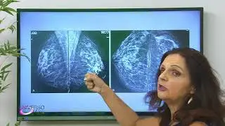 CÂNCER DE MAMA - PREVENÇÃO