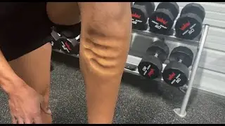 David Goggins INSANE Leg Injury