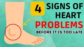 Recognising the signs of heart attack before it's too late.