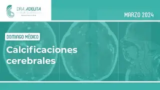 Calcificaciones cerebrales