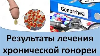Результаты лечения хронической гонореи