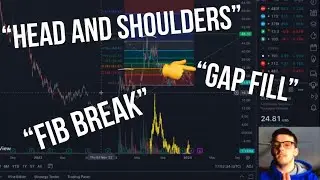 Buying This Selling That. (Lay Up Trades This Week)