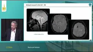 Coma  [Tutorial]  Raimund Helbok  NEURO ISICEM 2023