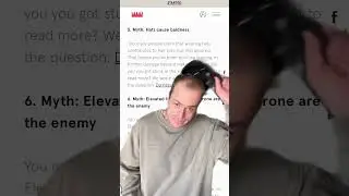 dont let anyone tell you these myths are true 😤 #recedinghairline #malepatternbaldness