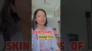 DIABETES- Skin signs😦🧑‍⚕️#medicine #doctor #neetpg #neet #shorts