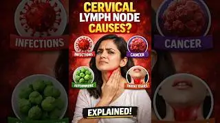 Neck lump? The most common cause? Cervical Lymphadenopathy.