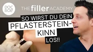 PFLASTERSTEINKINN mit BOTOX behandeln!! TFA by doc.rolf