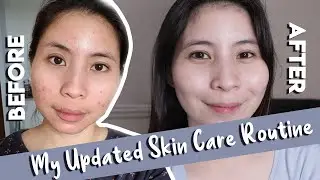 Updated Skin Care Routine | Paano Nawala Pimples Ko?