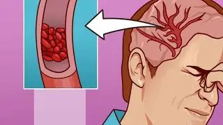 11 Signs Your Body Needs More Magnesium