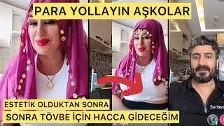 Kirasını Ödeyemeyen Yazgül Estetik Amelliyat Oluyor