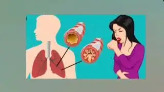 Ürək və təzyiq xəstəliyi psixi problemlər yarada bilir.