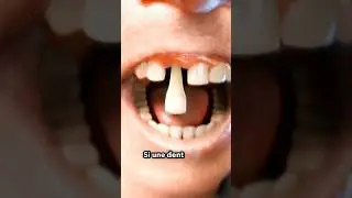 What to do if a tooth falls out 😳