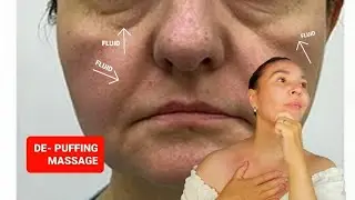 De-Puffing Lymphatic-Drainage Massage for PUFFY FACE