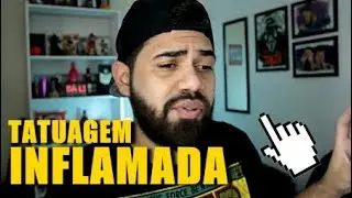 MINHA TATUAGEM INFLAMOU. O QUE DEVO FAZER?