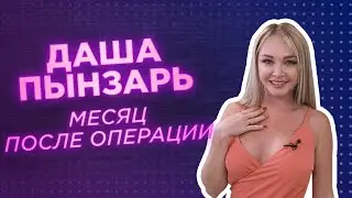 ДАРЬЯ ПЫНЗАРЬ: месяц после операции СМАС. Подтяжка лица и шеи!