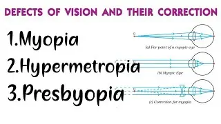 Myopia, Hypermetropia, Presbyopia, DEFECTS IN HUMAN EYE AND THEIR CORRECTION, Class 10 physics
