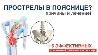 Прострелы в пояснице? 5 ЭФФЕКТИВНЫХ УПРАЖНЕНИЯ которые помогут!
