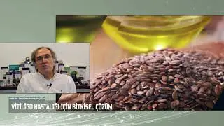 Vitiligo Şikayetine Karşı Öneriler | Prof. Saraçoğlu Anlatıyor!