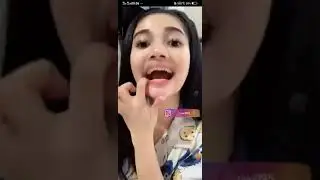 Bigo Live Uwill Mau Ke Dokter Gigi