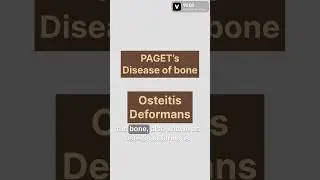 Paget’s disease of bone quick review #mrcp #doctor #neetpg #medicalstudent #medicaleducation