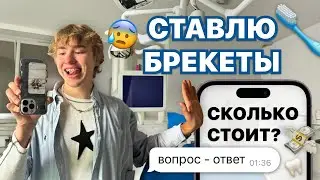 влог: ставлю брекеты + отвечаю на вопросы о них