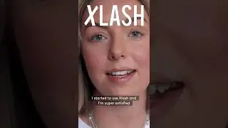 Xlash Eyelash Serum Review - Is it worth the hype? Xlash #EyelashSerum #NaturalBeauty