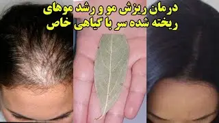 درمان ریزش مو و رشد موهای ریخته شده سر
