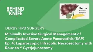 Derby HPB Surgery - Ep. 4: Laparoscopic Infracolic Necrosectomy with Roux en Y Cystjejunostomy