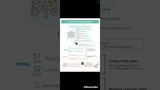 Auscultating Heart Sounds
