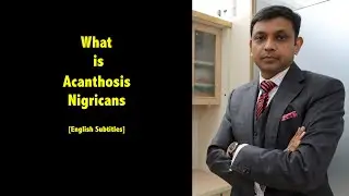 What is Acanthosis Nigricans; Its Causes & Risk Factors; Lab Investigations