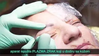 Plasma pen Beograd - Vračar i Bežanijska kosa - Save Time Studio i edukativni centar