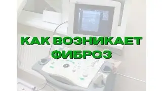 Почему Боль в спине НЕ проходит или Как  возникает МИОФИБРОЗ?