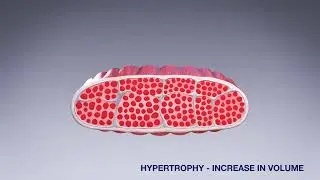 Электромагнитная стимуляция BTL EMSCULPT
