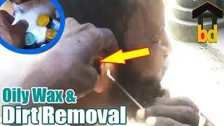 ►Huge Dirt & Wax Removal at Roadside ASMR II Special Guys at Ear Cleaning Point-Got Super Relaxation