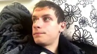 Edis i avarija pateko?! Kas dt?!!!
