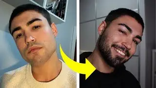CÓMO HACER CRECER LA BARBA NATURAL Y RÁPIDO (SIN MINOXIDIL)