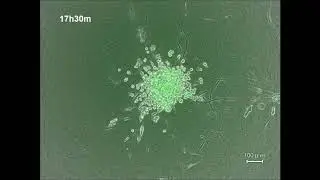 Cancer cell migration on elongate protrusions of fibroblasts in collagen matrix