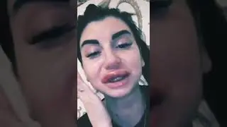 тяжёлый случай гелауронка, у девушки лопнет губа. ампутация?