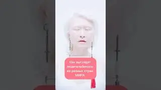 Как выглядят люди-альбиносы из разных стран мира 