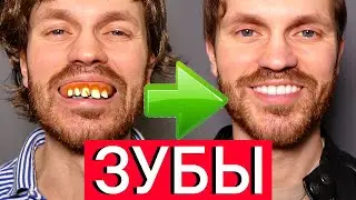 ТОТАЛЬНОЕ руководство по твоей идеальной улыбке