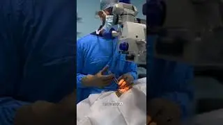 Cataract Eye Surgery!!! 