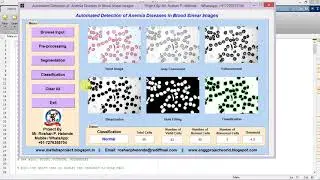 Anemia Detection in Blood Smear Images Using Image Processing Matlab Project Code