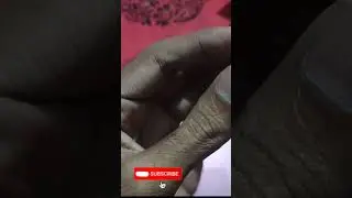 Best Camera Lens Protector Ring