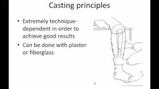 General principles of ortho trauma for PA students 3 - treatment
