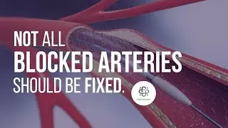 Not All Blocked Heart Arteries Should Be Fixed. Here’s Why. HealthspanMD
