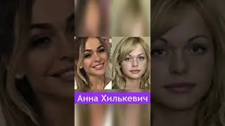 3 Звезды ПРОТИВ пластики #шоубизнес #новости
