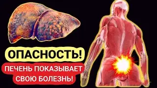 ЭТИ 14 ПРИЗНАКОВ! НЕ ИГНОРИРУЙТЕ ИХ!  Как на РАННЕЙ СТАДИИ распознать ПРОБЛЕМЫ С ПЕЧЕНЬЮ?