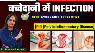 Pelvic inflammatory disease in Hindi | Symptoms, treatment in females | Dr Anupama Sharma
