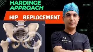 Hardinge approach | Lateral approach to hip | Live surgery